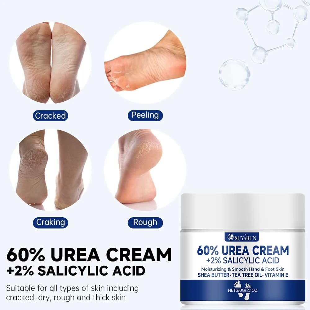 60% Urea Foot Cream – Intensive Moisturizer for Cracked Heels, Dry Skin & Rough Feet