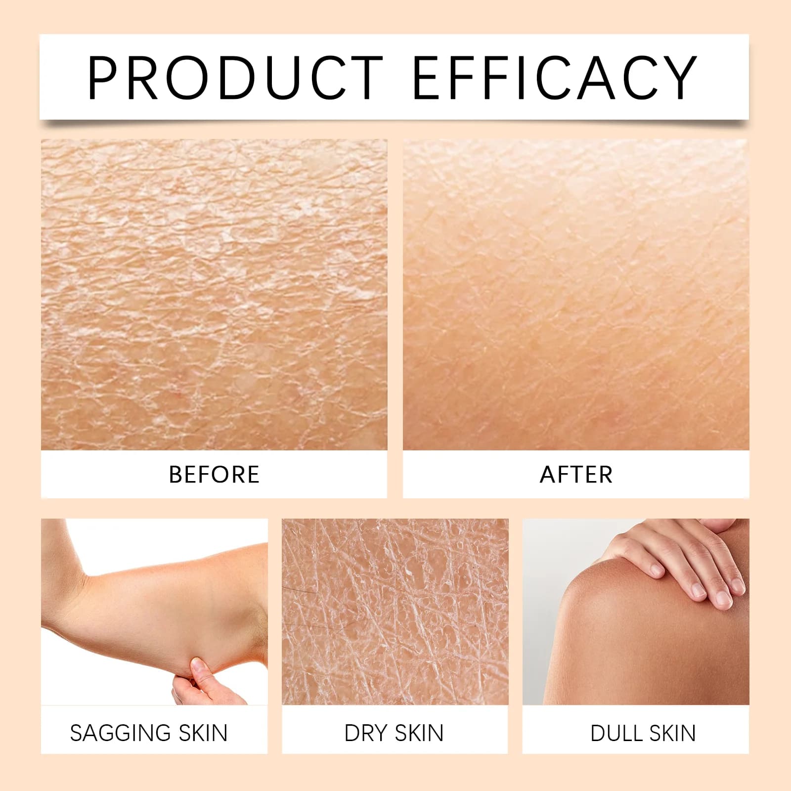 Whipped Beef Tallow Honey Balm – Hydrating Face & Body Moisturizer for Soft, Smooth-Looking Skin